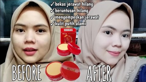 Krim dari Napas Pagi yang Terperangkap di Rambut: Terobosan Perawatan Kulit yang Unik dan Kontroversial